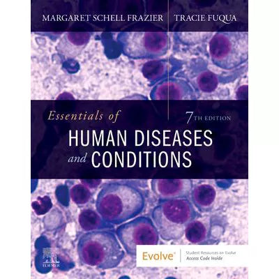 Essentials of Human Diseases and Conditions - E-Book